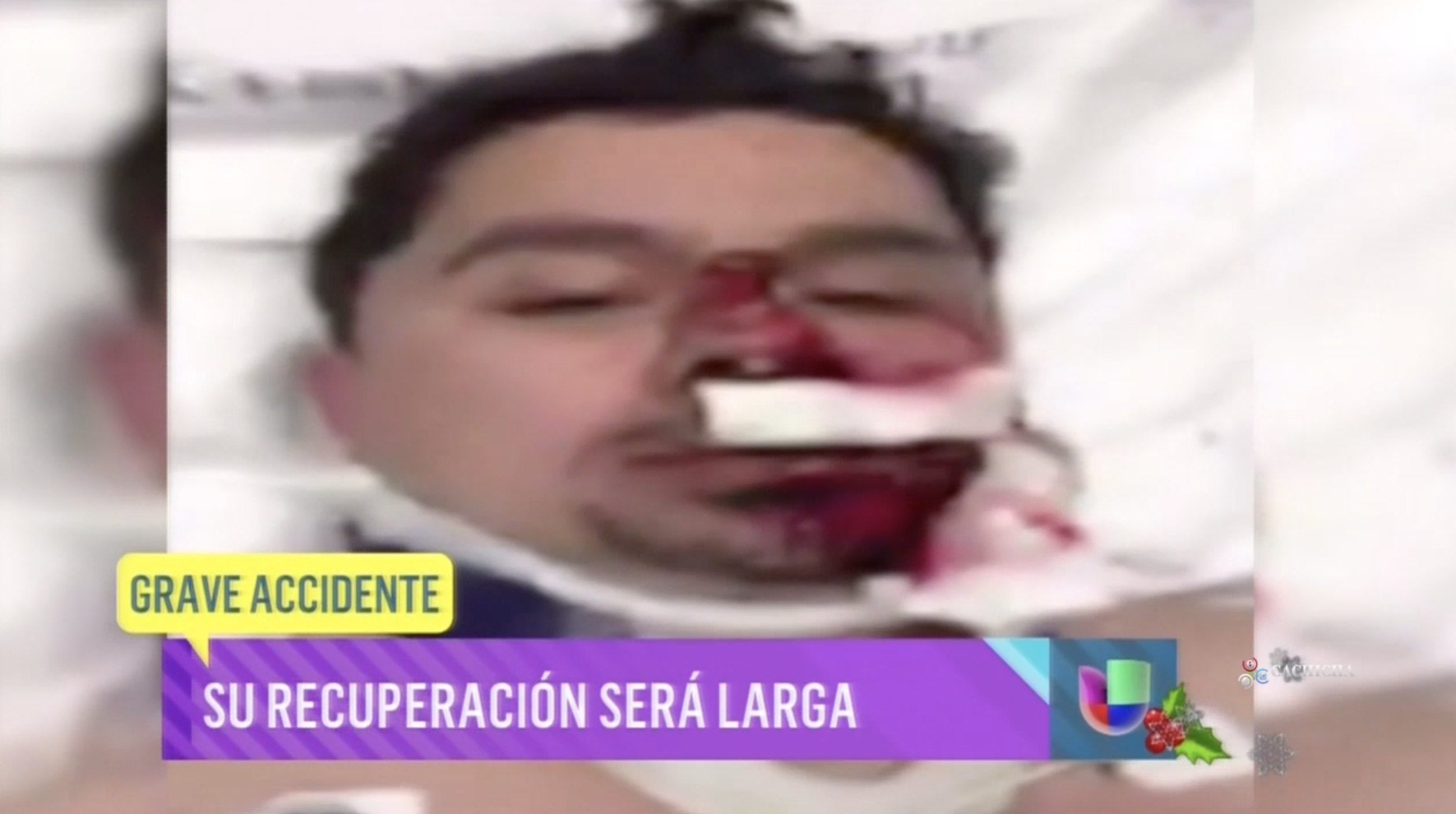 Este Famoso Cantante Mexicano Sufrió Un Terrible Accidente Mientras Transmitia En Vivo Por Facebook