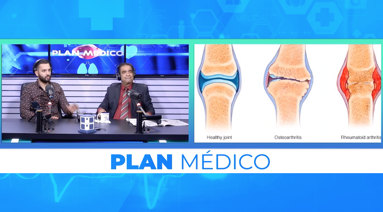 Artritis: Causas, Factores De Riesgo Y Las Complicaciones Que Esto Podría Ocasionar