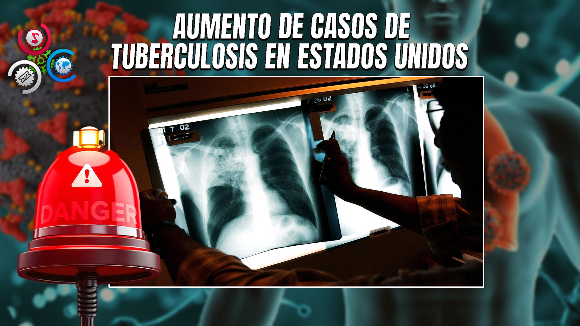 Se Confirma Un Caso De Tuberculosis Activa En Una Escuela Secundaria De Fort Lauderdale, Florida