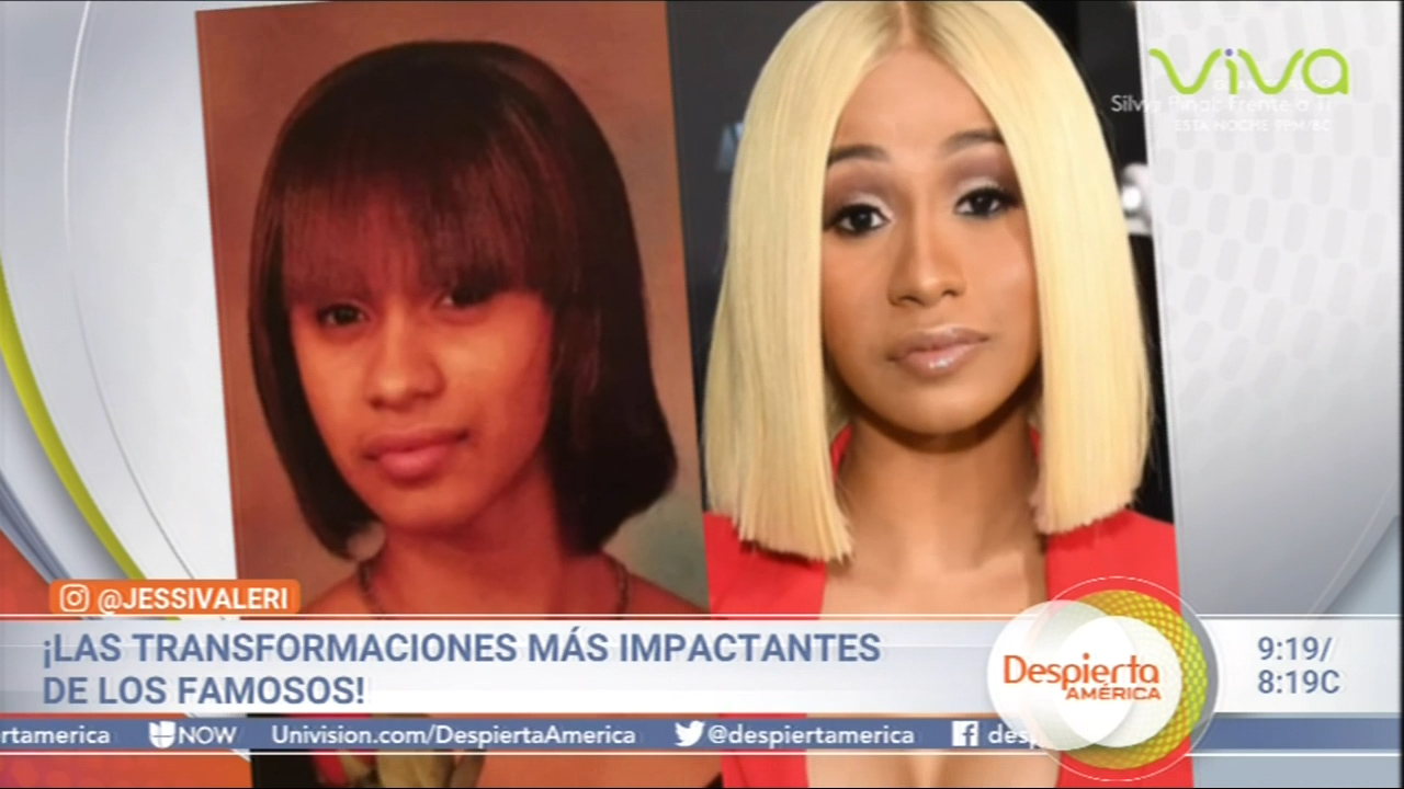 Así Lucían Algunas Estrellas Antes De Algunas Cirugías O Inyecciones De Aumento