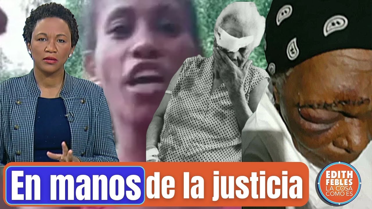 Seguimiento A Casos De Abuela Golpeada Por Su Nieto Y Madre Que Ocasionó Daños A Su Bebé