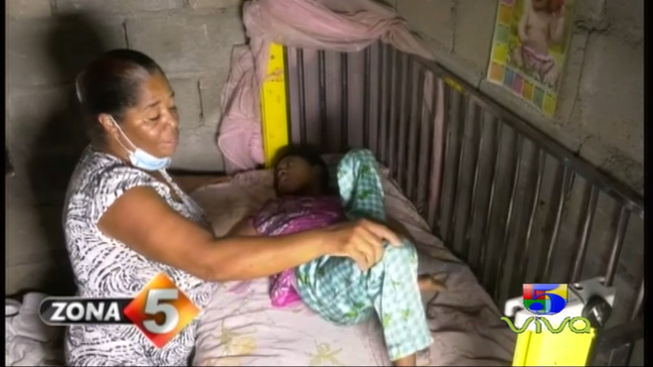 La Triste Historia De Una Joven Que Vive Postrada En Una Cama Culpa De Una Grabe Enfermedad