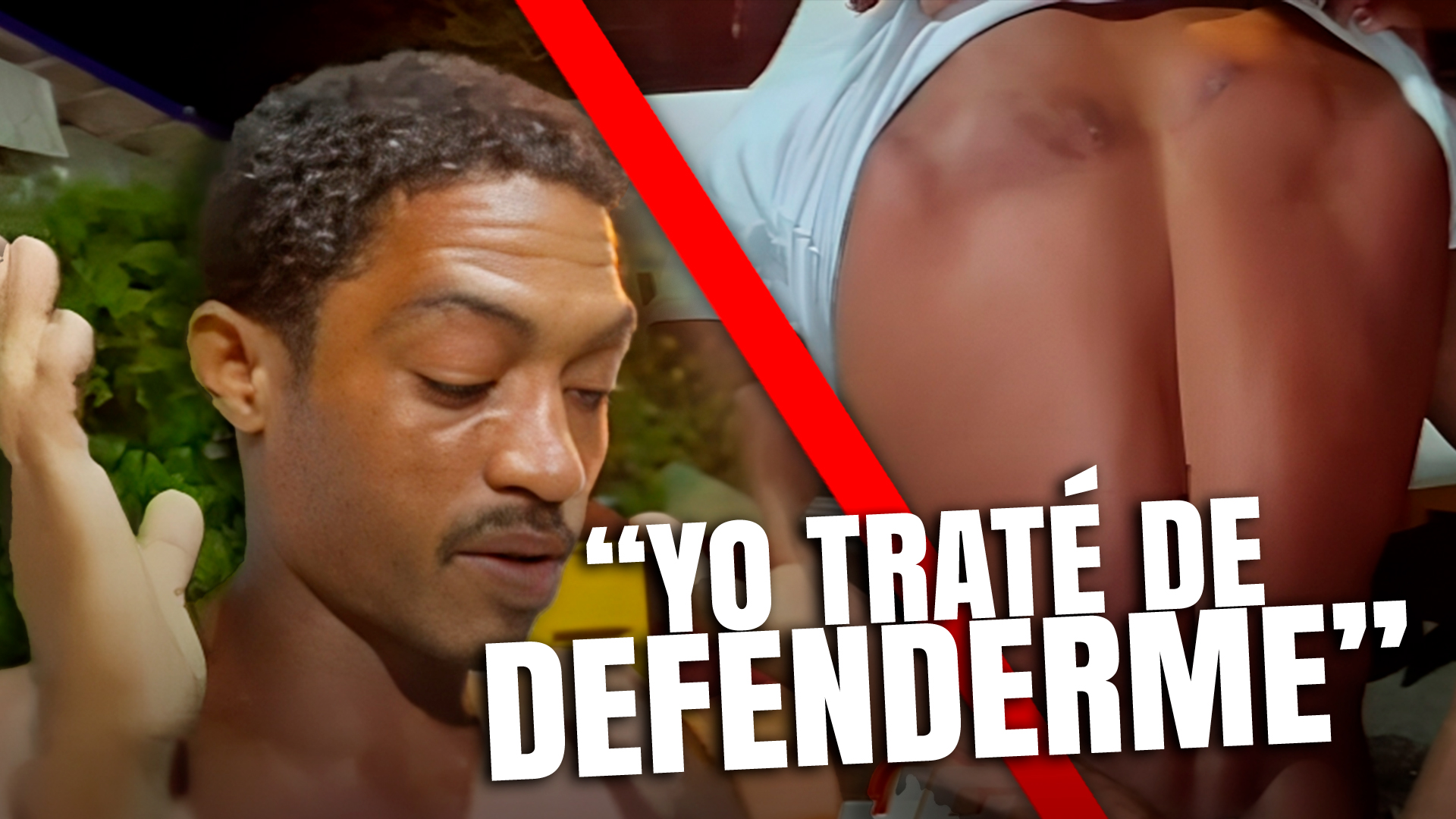 Individuo Acusado De Herir A Otro Por 300 Pesos En Dajabón Alega Fue En Defensa Propia