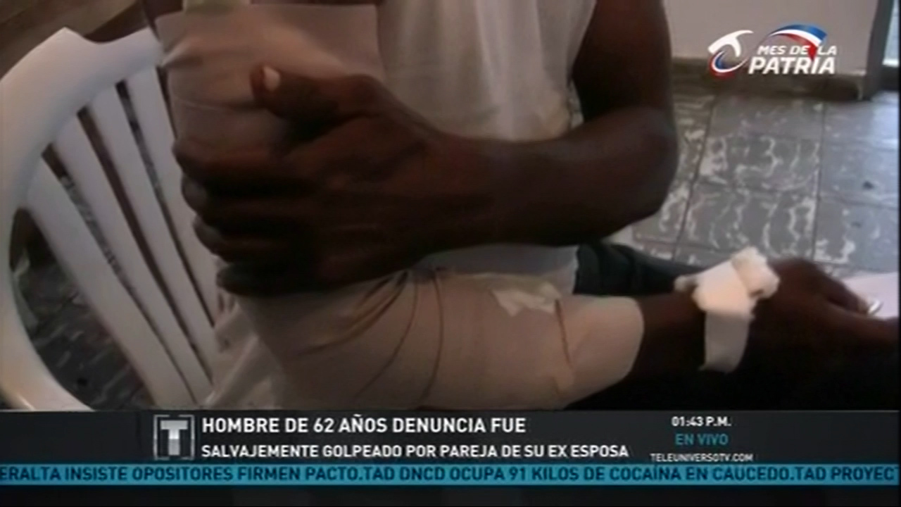 Hombre De 62 Años Denuncia Que Fue Salvajemente Golpeado Por Pareja De Su Ex Esposa