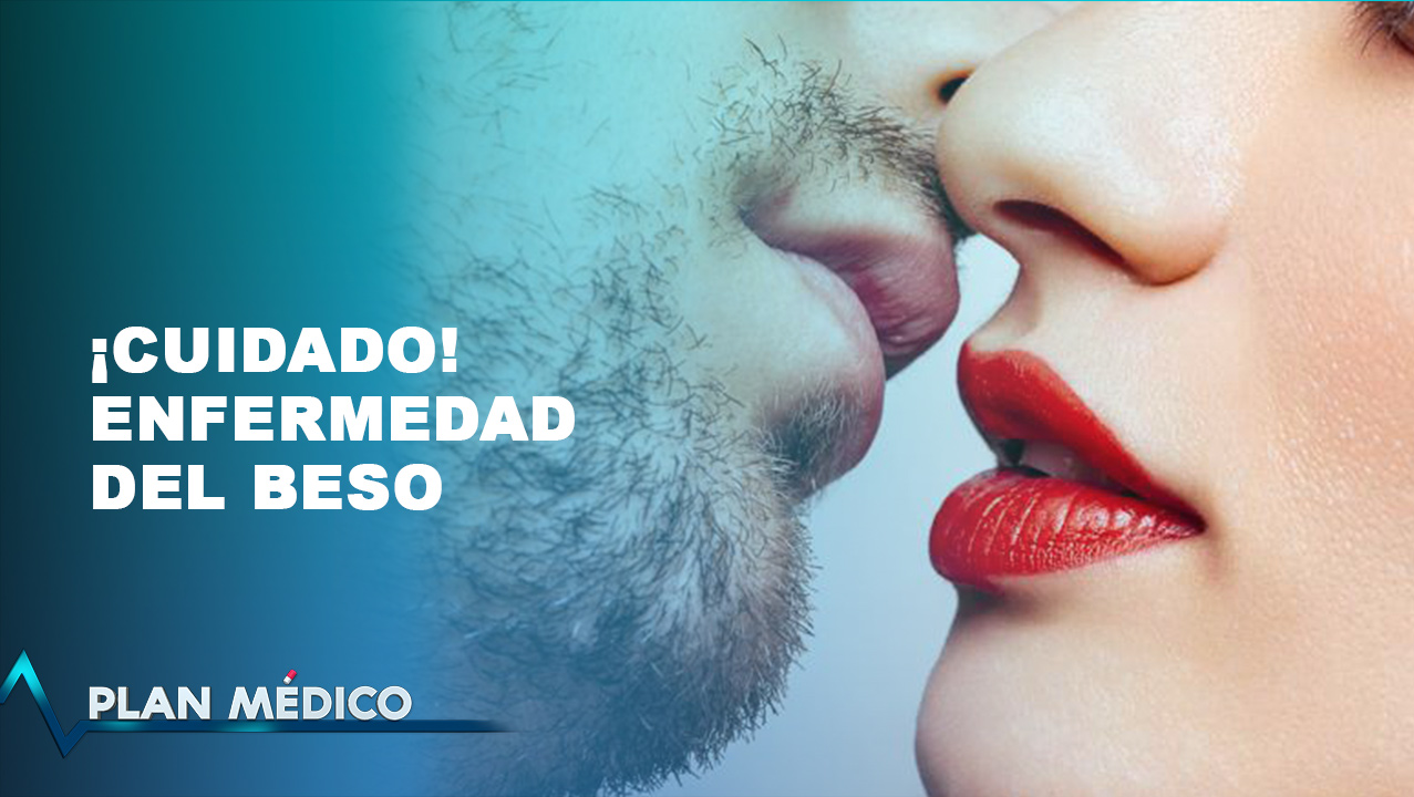 Enfermedades De Las Que Te Debes De Cuidar Al Besar | Plan Médico