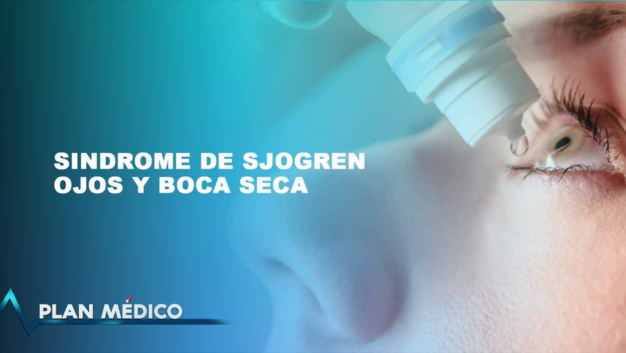 ¿Qué Es El Síndrome De Sjögren De Ojos Y Boca Seca? | Plan Médico