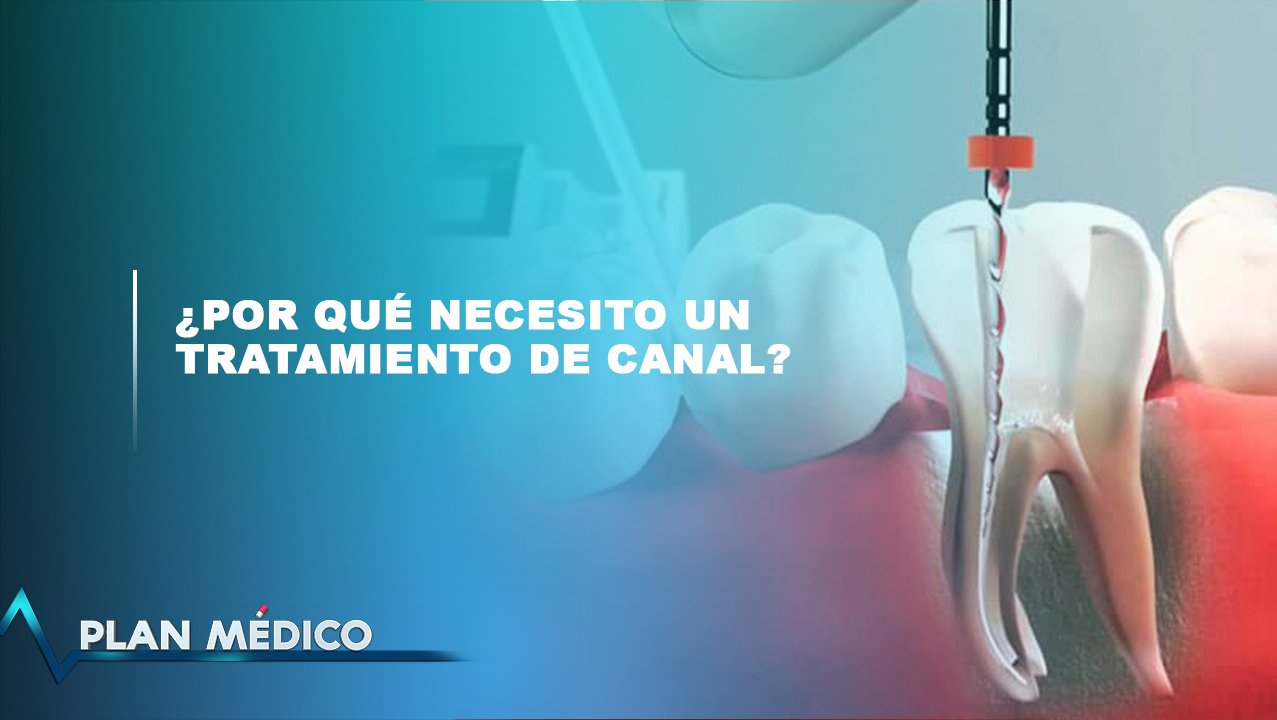 ¿Por Qué Necesito Un Tratamiento De Canal?
