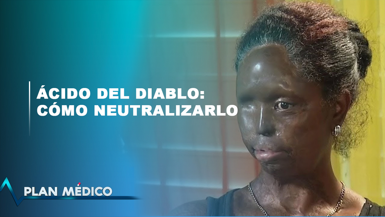 Ácido Del Diablo: Cómo Neutralizarlo | Plan Médico