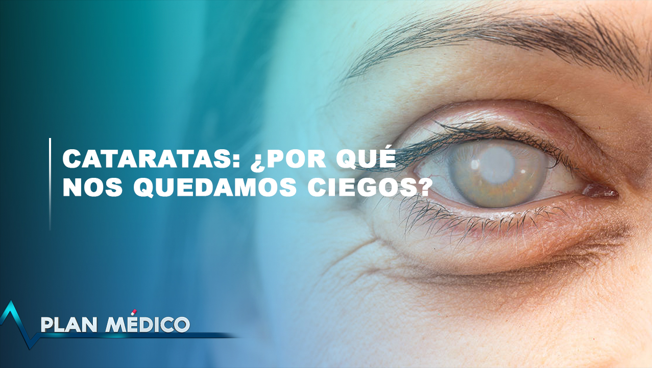 Cataratas: ¿Por Qué Nos Quedamos Ciegos? | Plan Médico