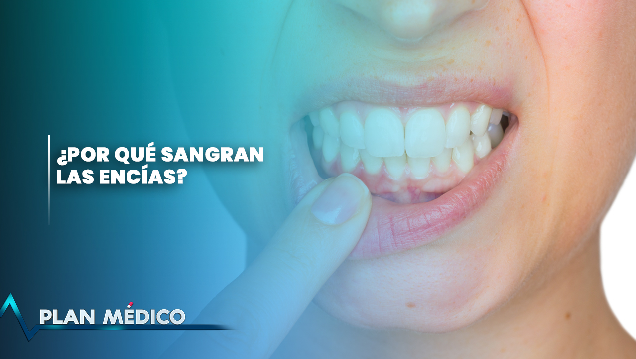 ¿Por Qué Sangran Las Encías? | Plan Médico
