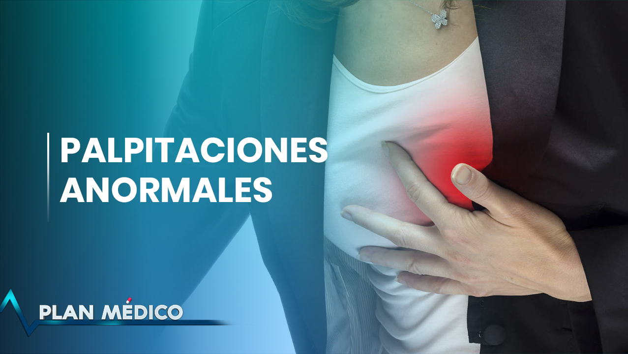 Palpitaciones Anormales | Plan Médico