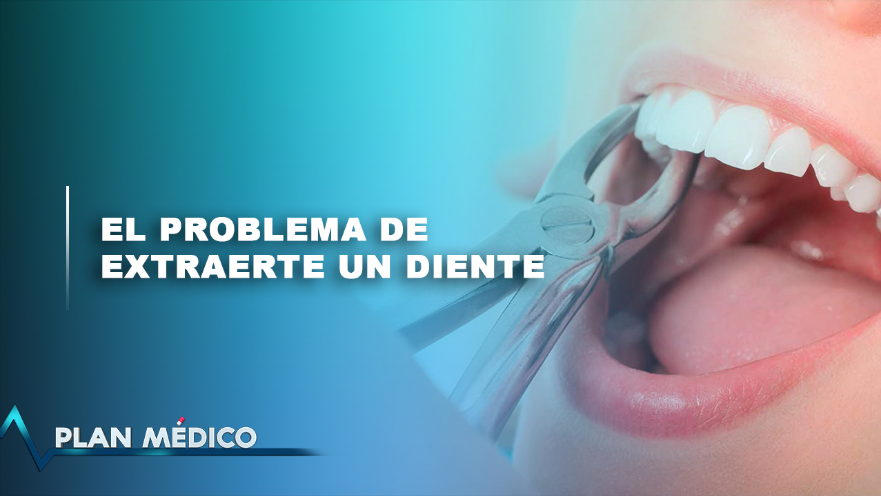El Problema De  Extraerte Un Diente | Plan Médico