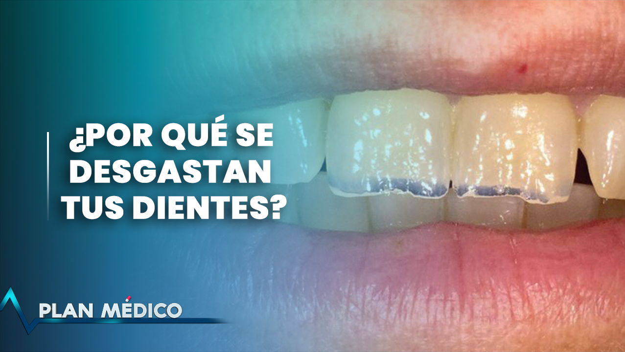 ¿Por Qué Se Desgastan Tus Dientes? | Plan Médico