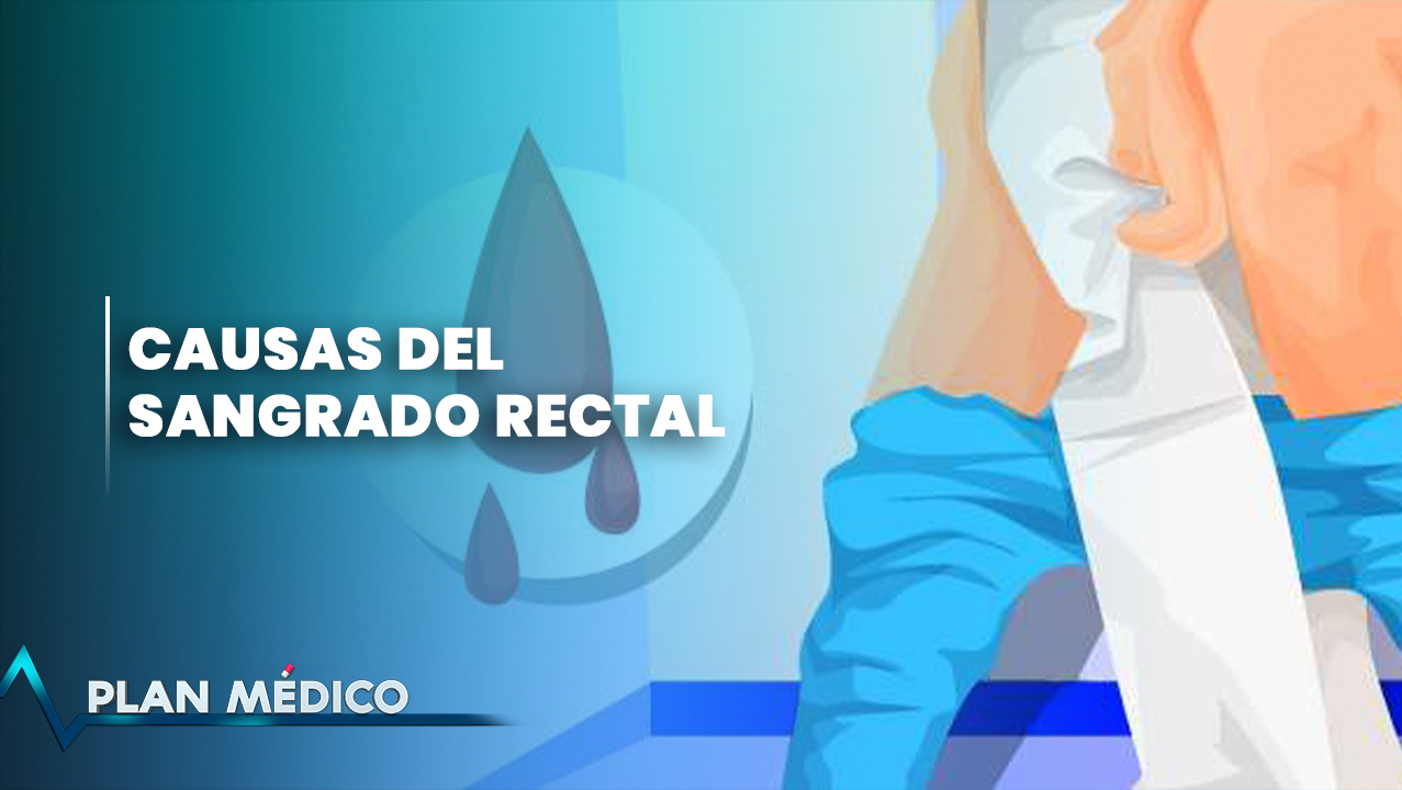 Causas Del Sangrado Rectal | Plan Médico