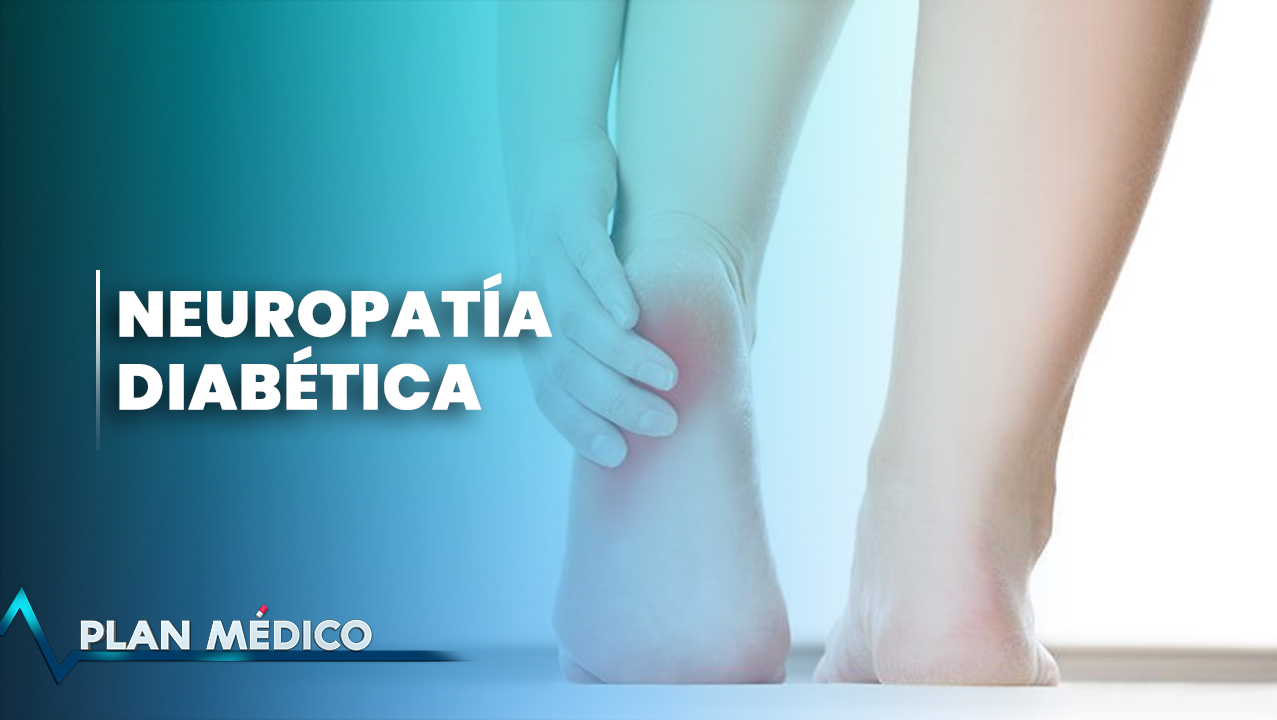 EN VIVO: Neuropatía Diabética | Plan Médico