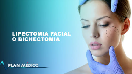 Conversando Sobre La Lipectomia Facial O Bichectomia Con El Dr. Núñez En Plan Médico