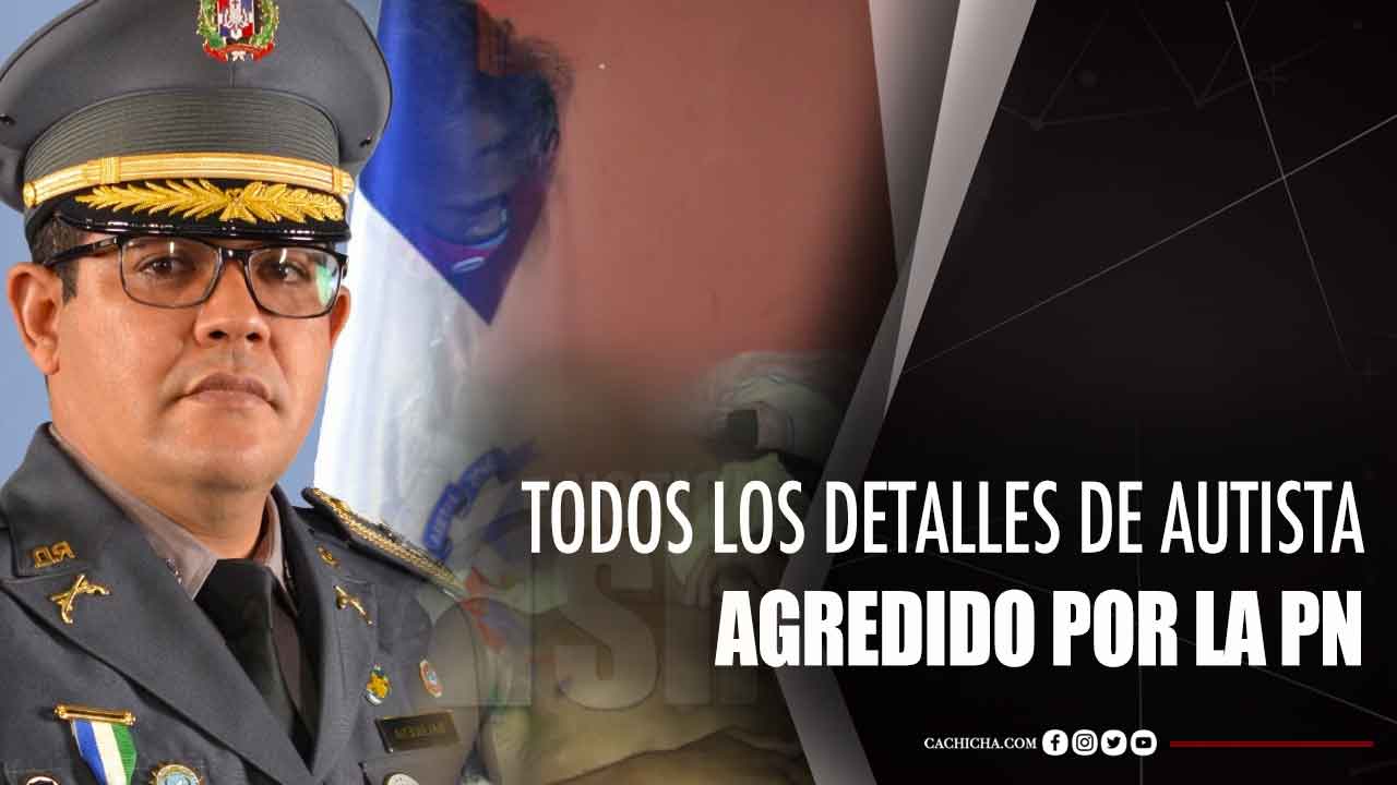 Todos Los Detalles De Autista Agredido Por La PN