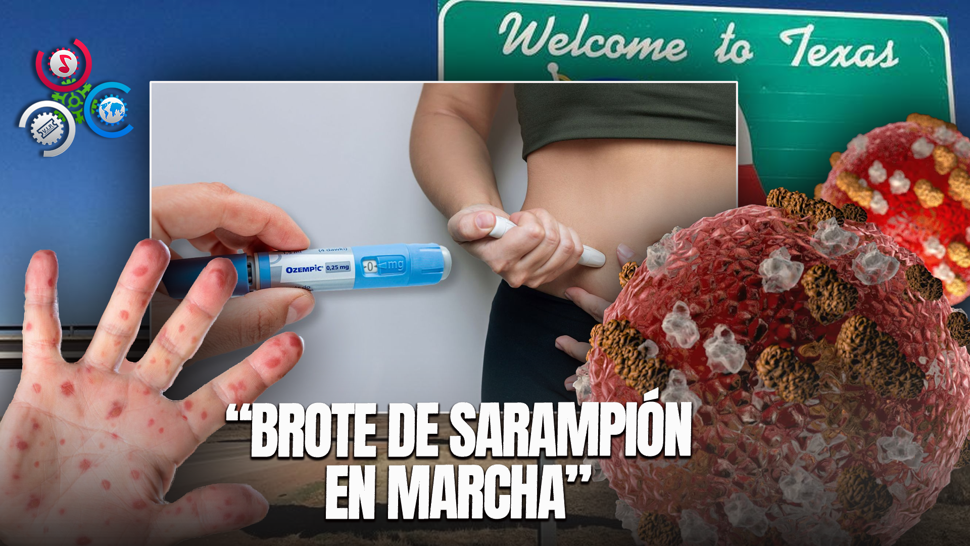 Un Brote De Sarampión Mantiene En Alerta A Texas