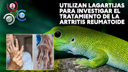 Utilizan Lagartijas Para Investigar El Tratamiento De La Artritis Reumatoide