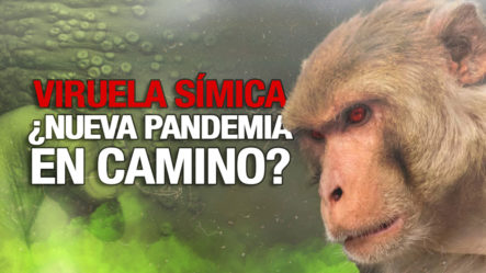 La Viruela Del Mono ¿Es Una Amenaza Para RD?