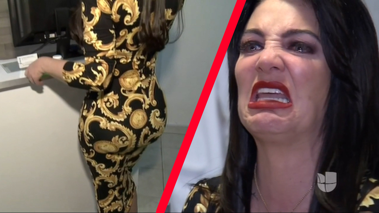 Actriz Uruguaya Da Su Testimonio Tras Verse Al Borde De La Muerte Después Someterse A Inyección De Polímeros En Los Glúteos