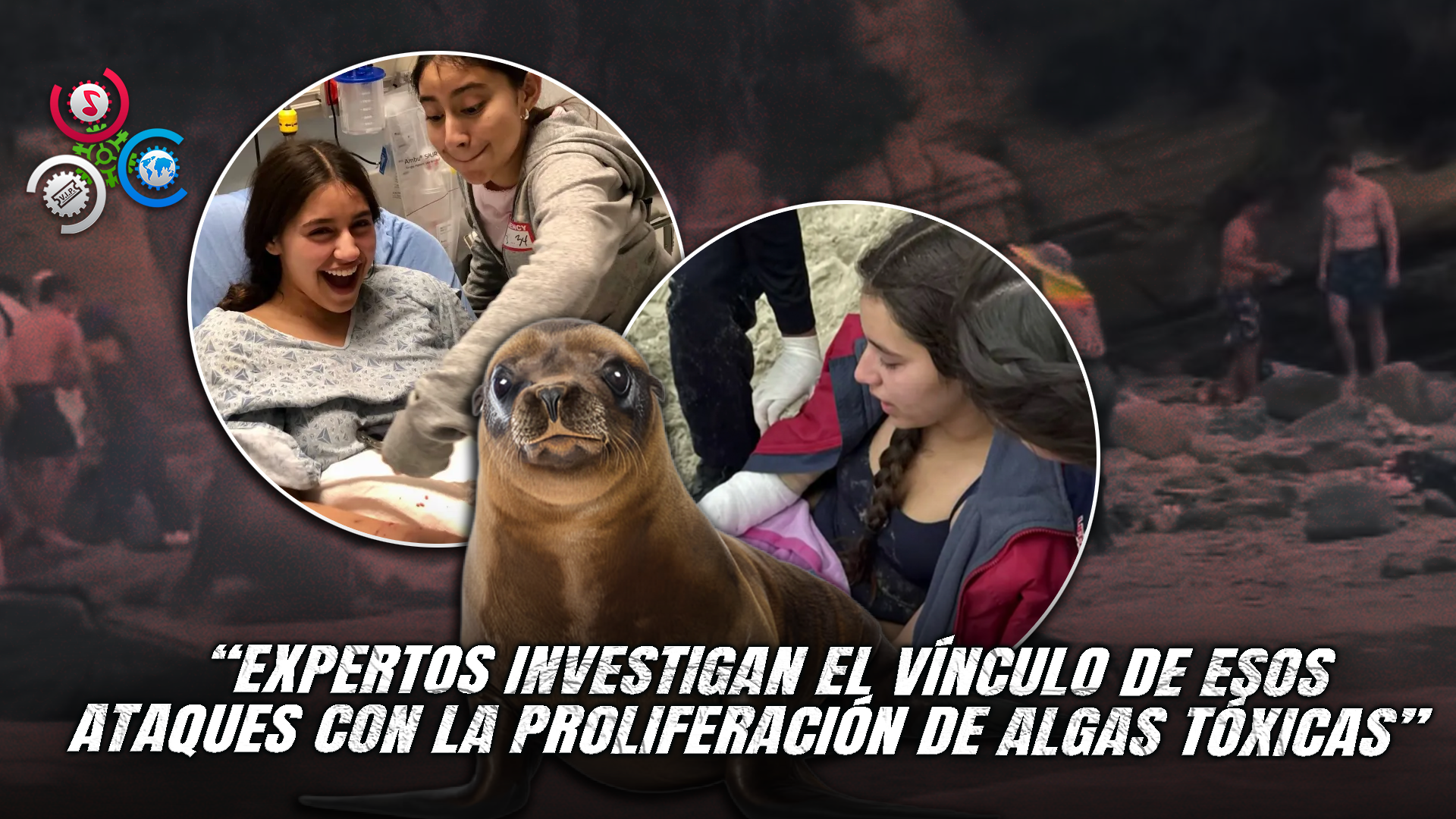 Ataque De León Marino A Joven En Long Beach Genera Preocupación