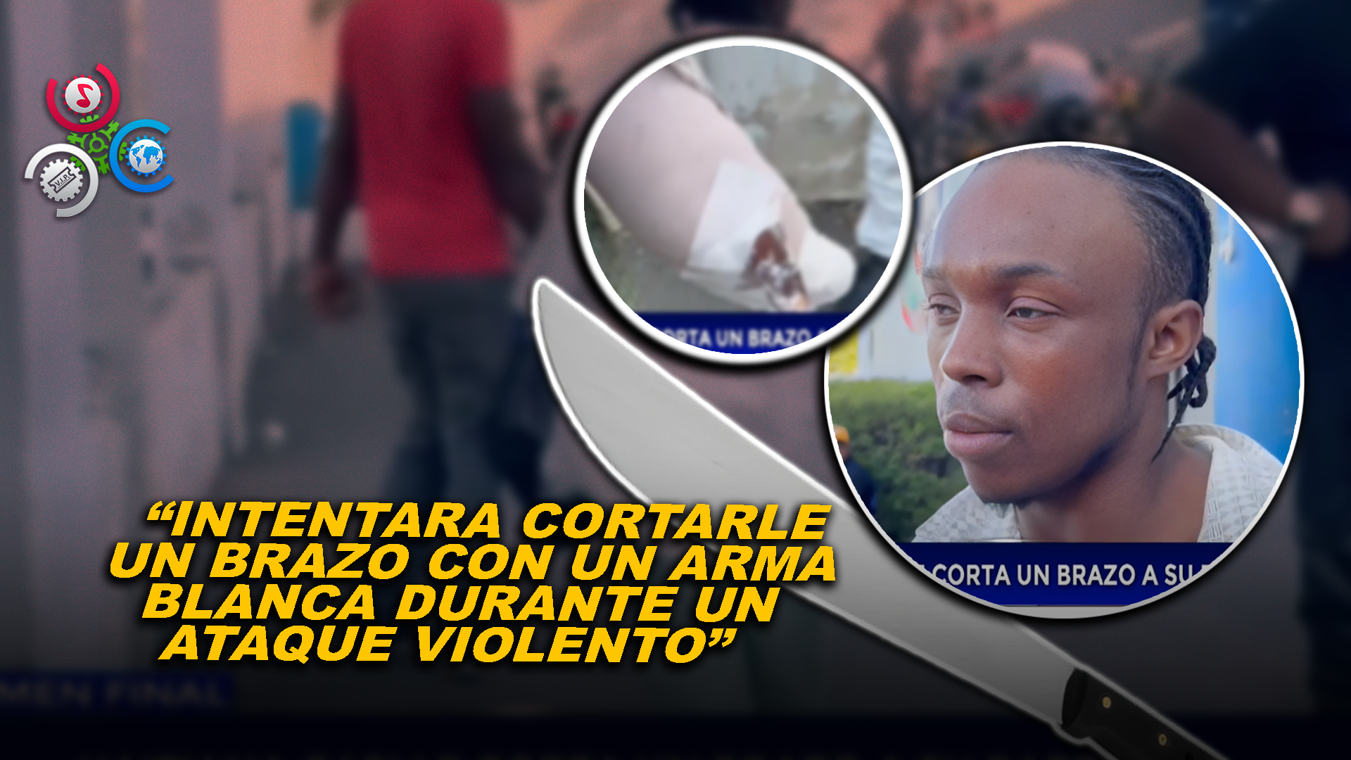 Violento Ataque: Mujer Haitiana Casi Le Corta Un Brazo A Su Compañero Sentimental