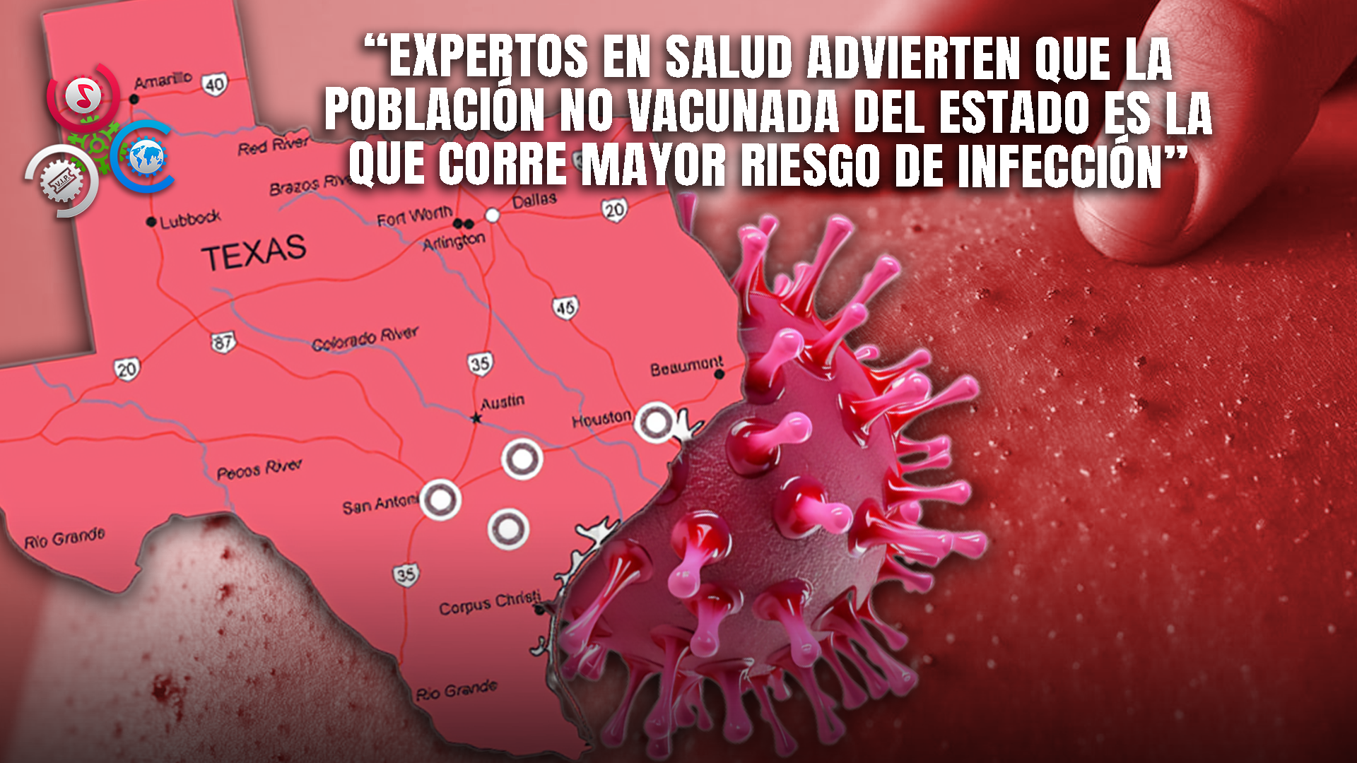 Salud Pública De Texas Activa Protocolo Tras Aparición De Casos De Sarampión