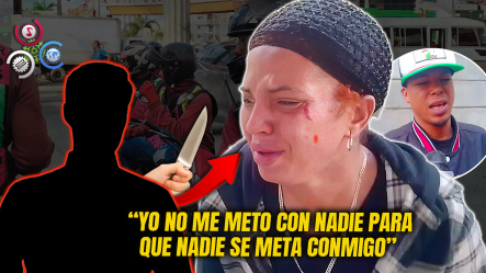 “Yo Fui A Defender Mi Marido Y él Me Dio”: Mujer Es Agredida En La Cara Por Motoconcho En Baracoa, Santiago
