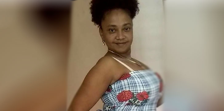 Más Detalles: Mujer Quemada Por Expareja Tiene Más Del 95% De Quemaduras En Su Cuerpo