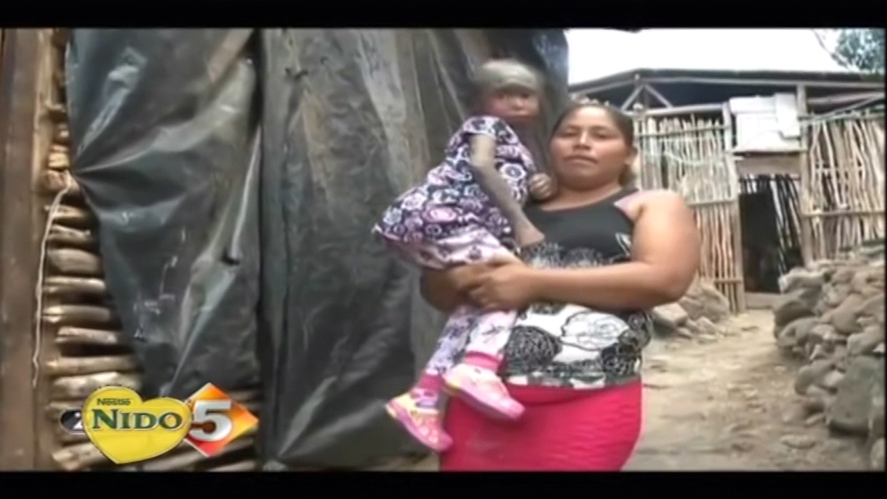 La Extraña Enfermedad Que Padece Una Pequeña Niña De 7 Años