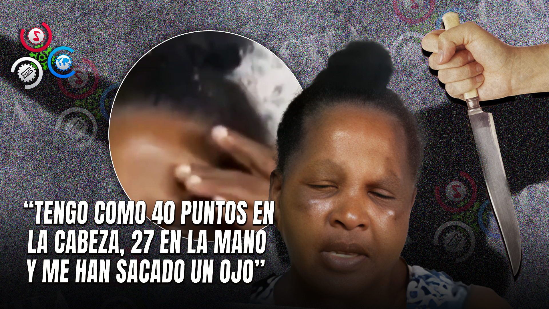 Joven Apuñala A Su Abuela En Un Intento De Quitarle La Casa En San Pedro De Macorís