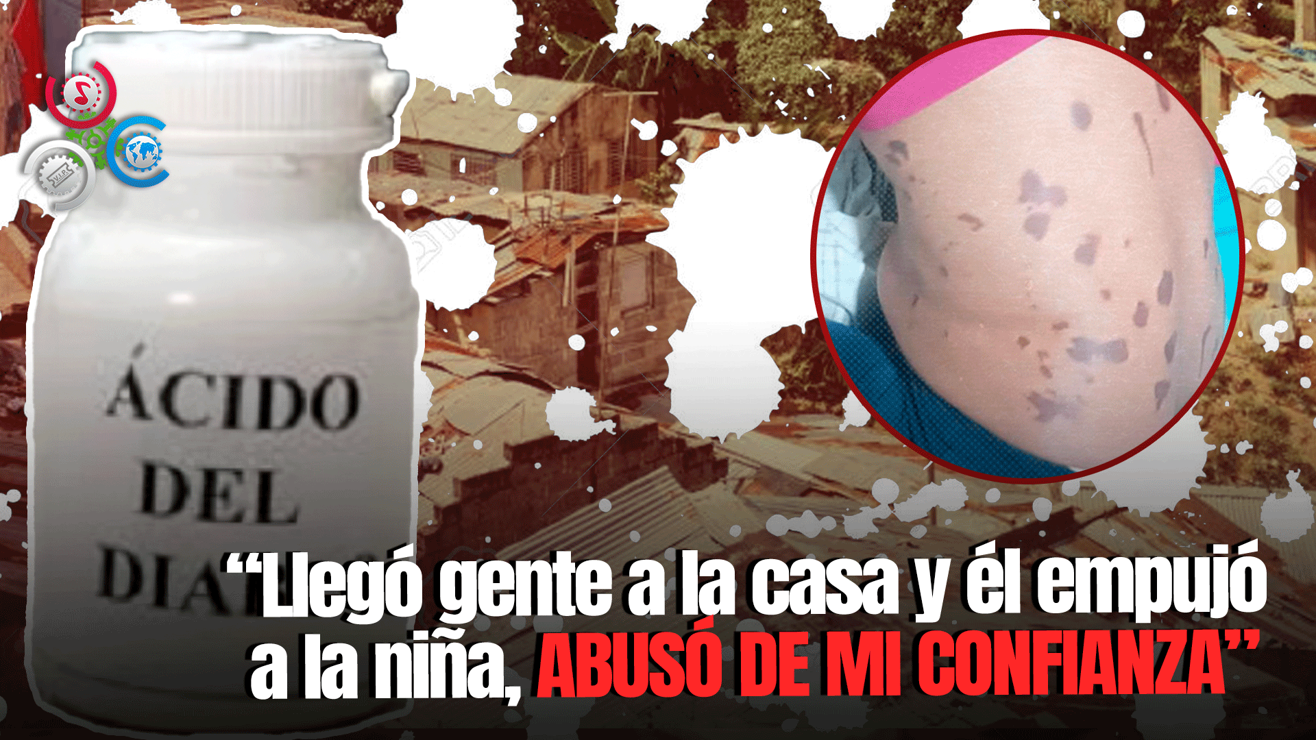 Atacan A Mujer Y A Su Hija Con ‘ácido Del Diablo’ En Capotillo En Represalia A Condena De Un Hombre