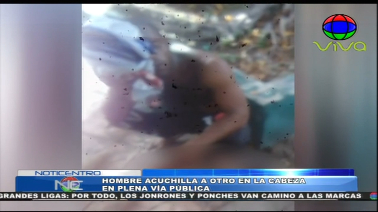 Hombre Acuchilla A Otro En La Cabeza En Plena Vía Pública