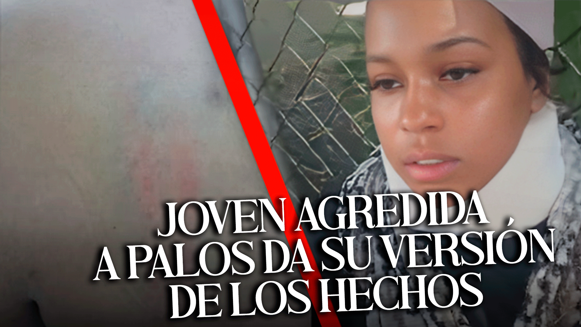 JOVEN AGREDIDA A PALOS DA SU VERSIÓN DE LOS HECHOS
