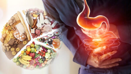 Alimentos Que Te Pueden Causar Mala Digestión | Plan Médico