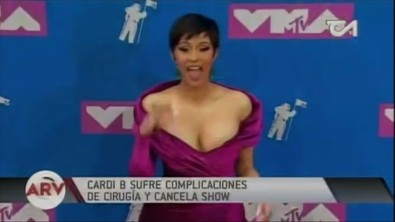 Cardi B Sufre Complicaciones De Cirugía Y Cancela Show