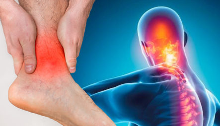 Como Identificar Cuando Padeces De Artritis Psoriásica 