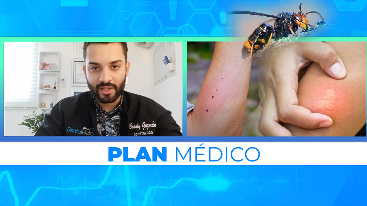 Conoce Más Sobre La Avispa Asesina Y Qué Hacer para No Sufrir Picadura