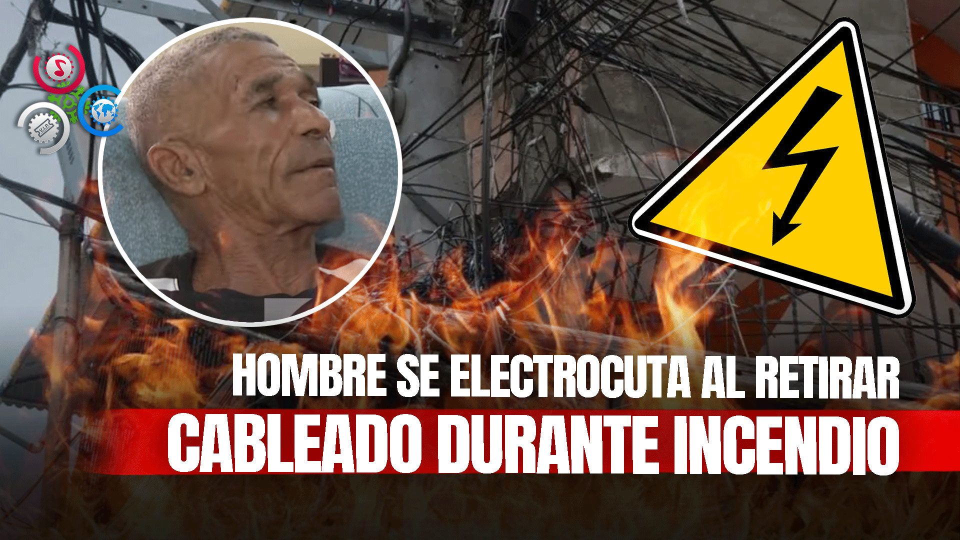 Hombre Sufre Quemaduras De Gravedad Tras Descarga Eléctrica En Sector Los Guandules