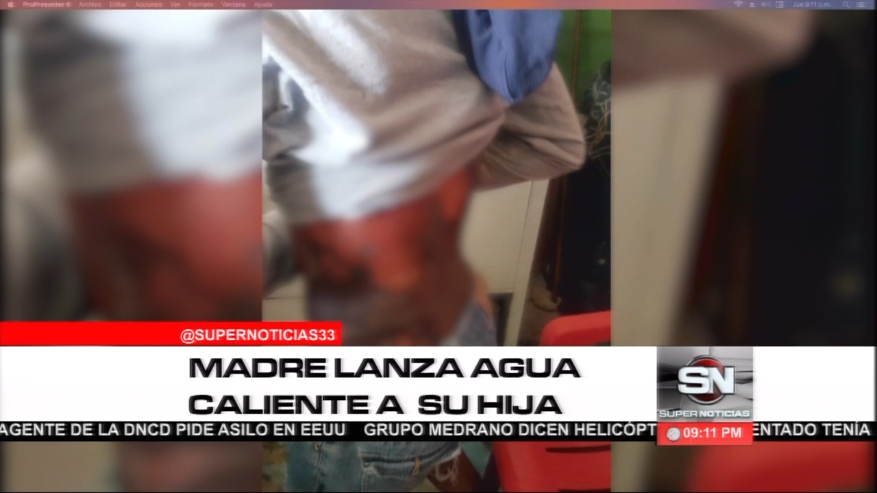 Madre Lanza Agua Caliente A Su Hija