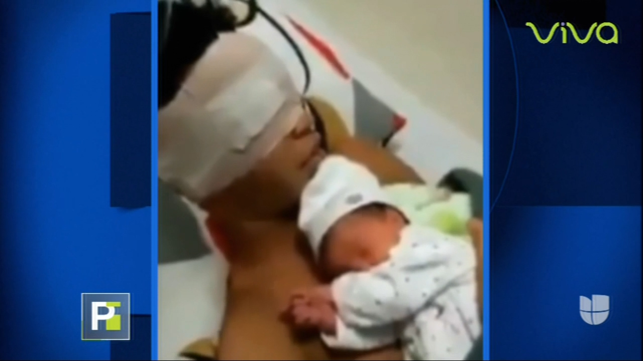 Reportaje De Primer Impacto Sobre El Joven Que Perdió La Vista Tras Ser Asaltado