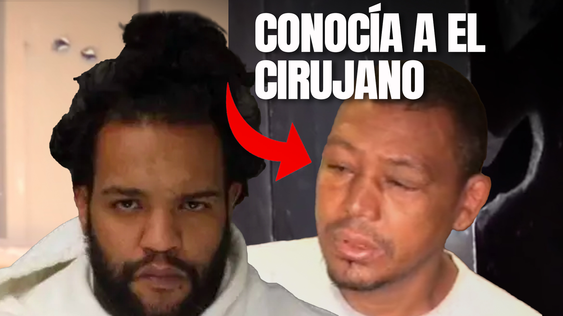 Conocido De El Cirujano Revela Lo Que Este Le Hizo Y Cuenta Cómo Era