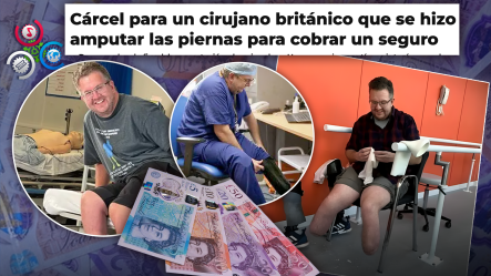 Cirujano Británico Condenado A 32 Meses De Cárcel Por Amputarse Las Piernas Para Cobrar Un Seguro