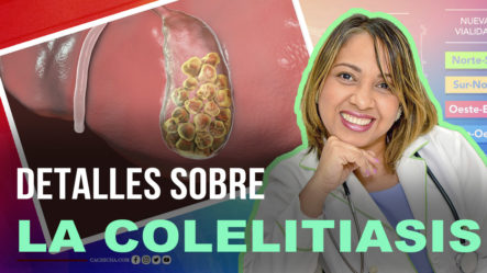 Conoce Todos Los Detalles Sobre La Colelitiasis  | Tu Mañana By Cachicha