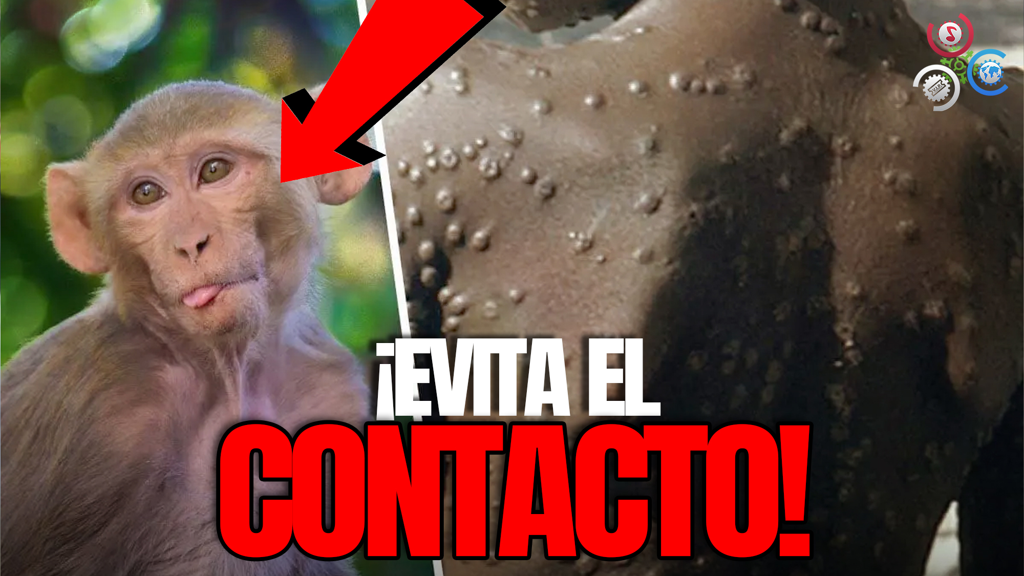 Todo Lo Que Tienes Que Saber Sobre La Viruela Del Mono | Evita El Contacto