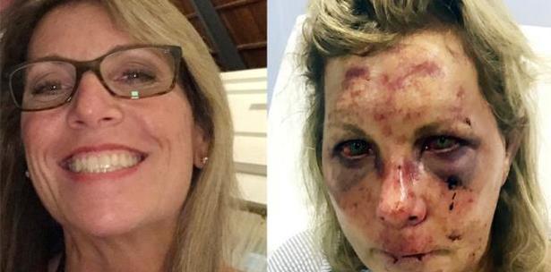 Pareja Estadounidense Pidió 2.2 Millones De Dólares De Indemnización A Hotel