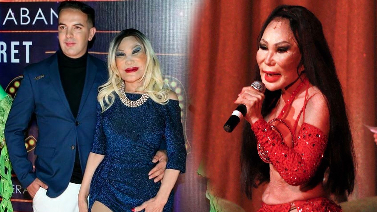 ¿Te Casarías Con Lyn Mai A Pesar De Su Terrible Aspecto?