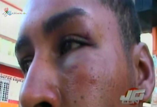 Policía Le Entra A Golpes En La Cara Con Su Pistola A Un Joven #Video