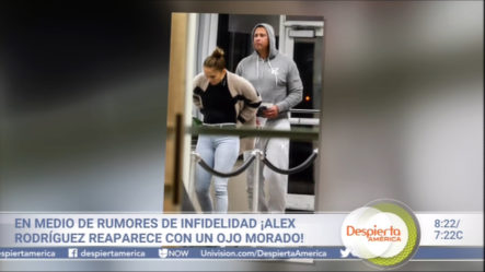 Alex Rodríguez Reaparece Con Un Ojo Morado